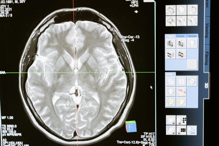 Diagnostic imaging of a person's brain.